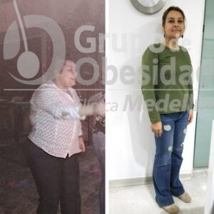 Pacientes de Balón Gástrico