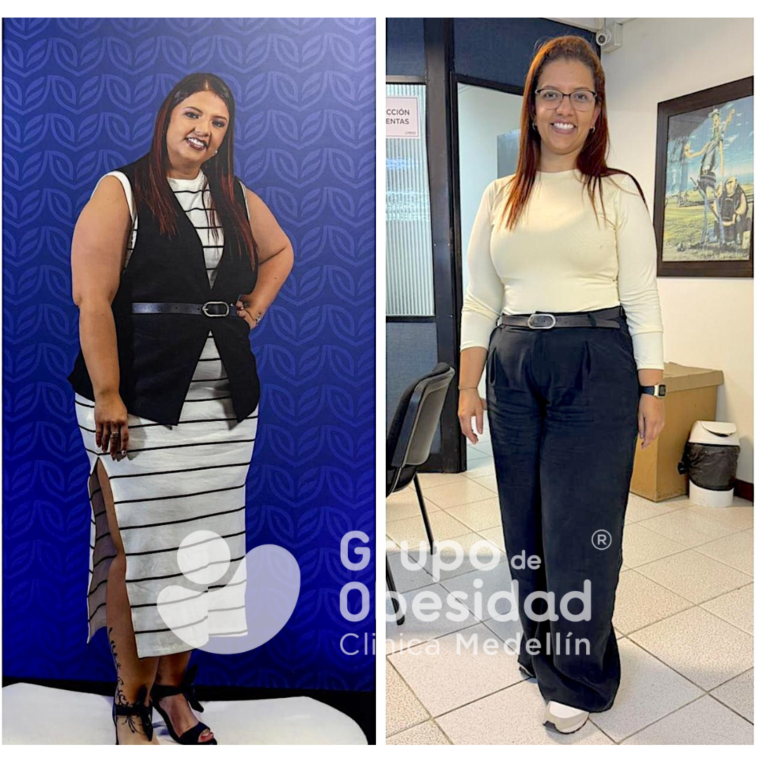 paciente experiencia balon gastrico
