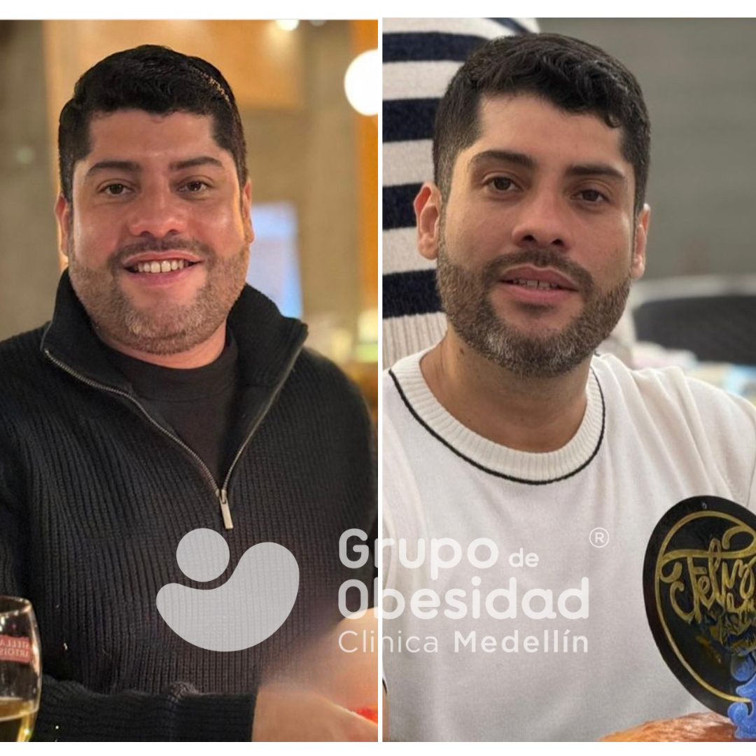 antes y despues