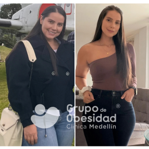experiencia balon gastrico
